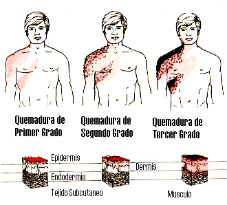nunca esta de mas